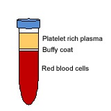 通过离心机进行红细胞稀有血型筛选、建库与应用